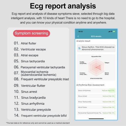 1.43 inch Leather Strap Bluetooth Call Smart Watch Support ECG / Non-invasive Blood Sugar